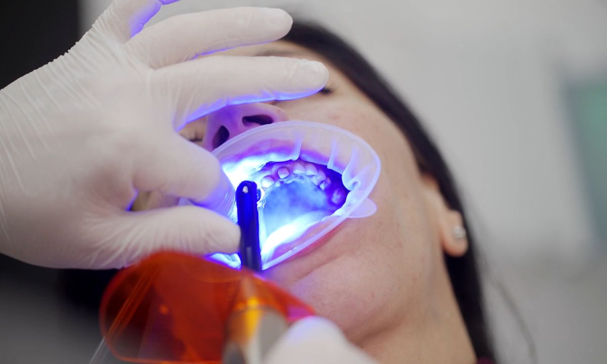 zubar plombira zub devojci