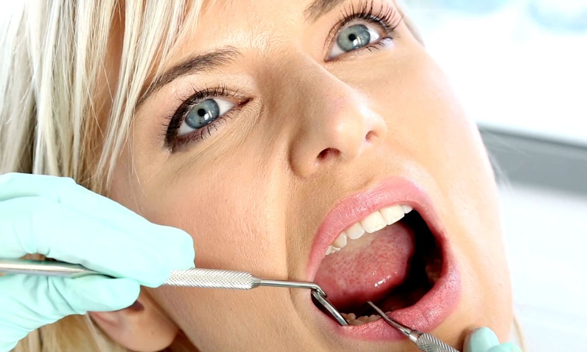 zubar uklanja karijes devojci